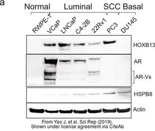 Anti-HOXB13 antibody used in Western Blot (WB). GTX129245
