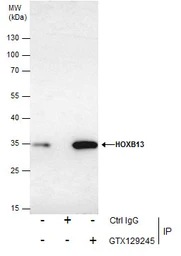 Anti-HOXB13 antibody used in Immunoprecipitation (IP). GTX129245