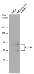 Anti-FOXP1 antibody used in Western Blot (WB). GTX129252