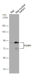 Anti-FOXP1 antibody used in Western Blot (WB). GTX129252