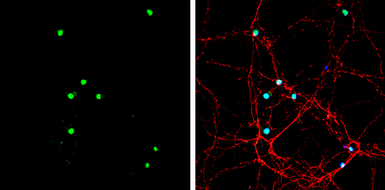 Anti-Neurogenin 2 antibody used in Immunocytochemistry/ Immunofluorescence (ICC/IF). GTX129258