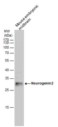 Anti-Neurogenin 2 antibody used in Western Blot (WB). GTX129258