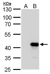 Anti-NKX2.3 antibody used in Western Blot (WB). GTX129262