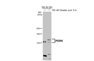 Anti-PERK antibody used in Western Blot (WB). GTX129275