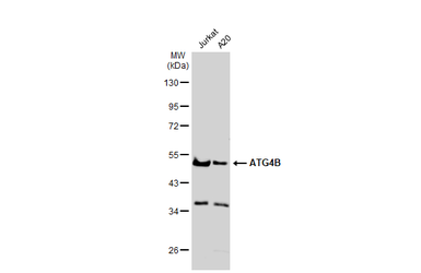 Anti-ATG4B antibody used in Western Blot (WB). GTX129276
