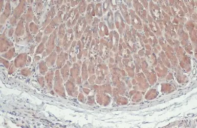 Anti-ATG4B antibody used in IHC (Paraffin sections) (IHC-P). GTX129276