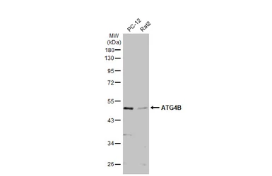 Anti-ATG4B antibody used in Western Blot (WB). GTX129276