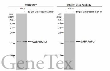 Anti-GABARAPL1 antibody used in Western Blot (WB). GTX129277