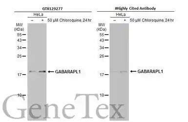 Anti-GABARAPL1 antibody used in Western Blot (WB). GTX129277