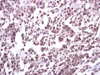 Anti-ERCC1 antibody used in IHC (Paraffin sections) (IHC-P). GTX129282