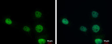 Anti-ERCC1 antibody used in Immunocytochemistry/ Immunofluorescence (ICC/IF). GTX129282