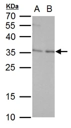 Anti-ERCC1 antibody used in Western Blot (WB). GTX129282