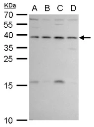 Anti-ERCC1 antibody used in Western Blot (WB). GTX129282