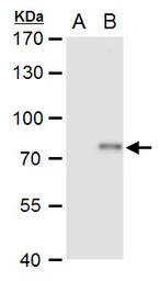 Anti-XPD antibody used in Western Blot (WB). GTX129284