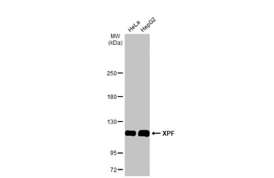 Anti-XPF antibody used in Western Blot (WB). GTX129286
