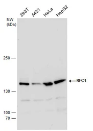 Anti-RFC1 antibody used in Western Blot (WB). GTX129292