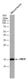 Anti-UBE2I antibody used in Western Blot (WB). GTX129293