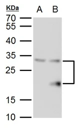 Anti-SMUG1 antibody used in Western Blot (WB). GTX129302