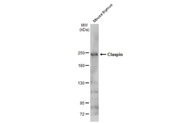 Anti-Claspin antibody used in Western Blot (WB). GTX129311