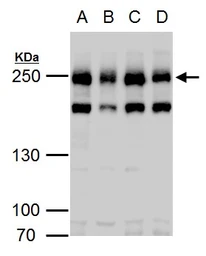 Anti-Claspin antibody used in Western Blot (WB). GTX129311