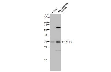 Anti-KLF9 antibody used in Western Blot (WB). GTX129316