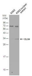 Anti-DLX4 antibody used in Western Blot (WB). GTX129318