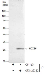 Anti-HOXB5 antibody used in Immunoprecipitation (IP). GTX129322