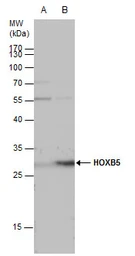 Anti-HOXB5 antibody used in Western Blot (WB). GTX129322