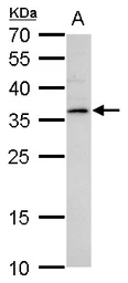 Anti-LYL1 antibody used in Western Blot (WB). GTX129329