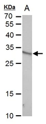 Anti-VENTX antibody used in Western Blot (WB). GTX129357