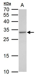 Anti-VENTX antibody used in Western Blot (WB). GTX129357
