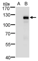 Anti-MKL1 antibody used in Western Blot (WB). GTX129372