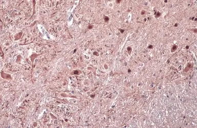 Anti-Islet 2 antibody used in IHC (Paraffin sections) (IHC-P). GTX129375