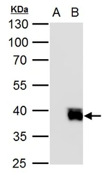 Anti-Islet 2 antibody used in Western Blot (WB). GTX129375