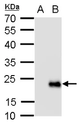 Anti-RGS19 antibody used in Western Blot (WB). GTX129412
