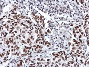 Anti-SP3 antibody used in IHC (Paraffin sections) (IHC-P). GTX129426