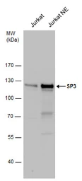 Anti-SP3 antibody used in Western Blot (WB). GTX129426