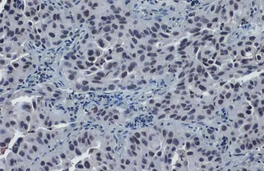 Anti-SP3 antibody used in IHC (Paraffin sections) (IHC-P). GTX129426