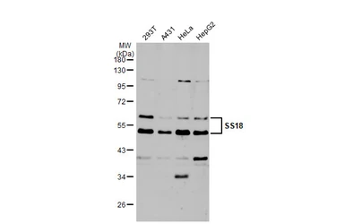 Anti-SS18 antibody used in Western Blot (WB). GTX129428