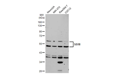 Anti-SS18 antibody used in Western Blot (WB). GTX129428
