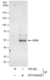 Anti-SS18 antibody used in Immunoprecipitation (IP). GTX129428