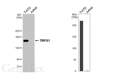 Anti-TRPS1 antibody used in Western Blot (WB). GTX129429