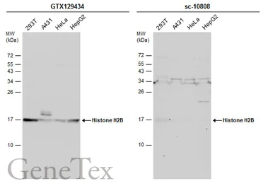 Anti-Histone H2B antibody used in Western Blot (WB). GTX129434