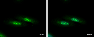 Anti-C1D antibody used in Immunocytochemistry/ Immunofluorescence (ICC/IF). GTX129439