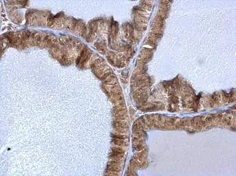 Anti-C1D antibody used in IHC (Paraffin sections) (IHC-P). GTX129439
