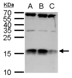 Anti-C1D antibody used in Western Blot (WB). GTX129439