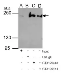 Anti-ARID2 antibody used in Immunoprecipitation (IP). GTX129443