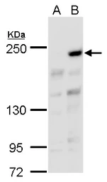 Anti-ARID2 antibody used in Western Blot (WB). GTX129443