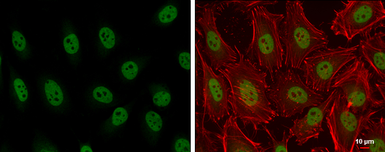 Anti-ARID2 antibody used in Immunocytochemistry/ Immunofluorescence (ICC/IF). GTX129443