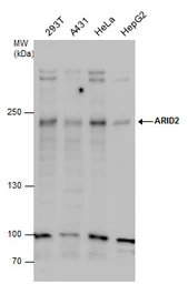 Anti-ARID2 antibody used in Western Blot (WB). GTX129444